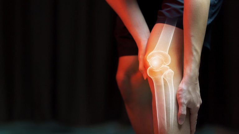 Knee Pain