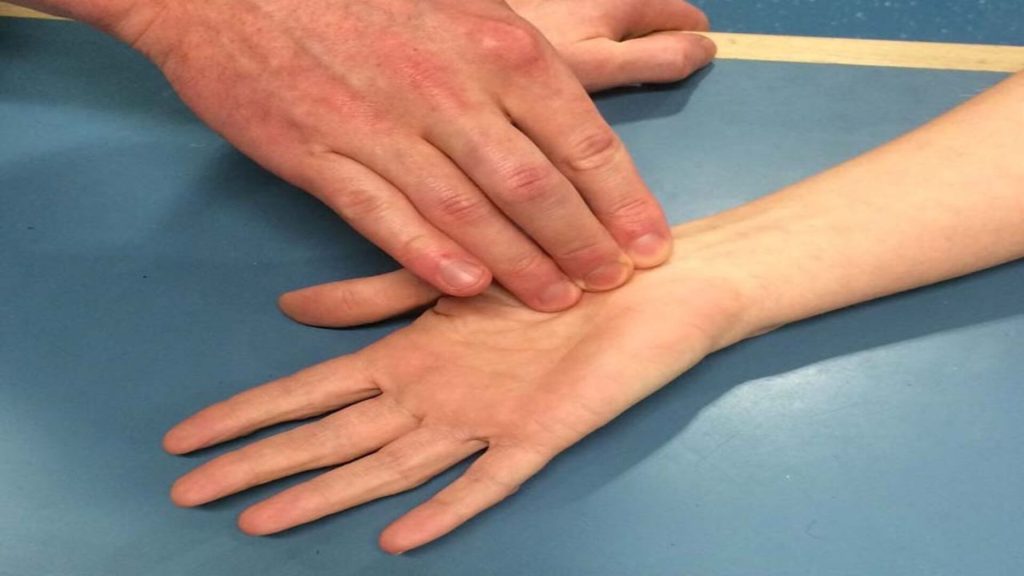 carpal tunnel syndrome treatment 