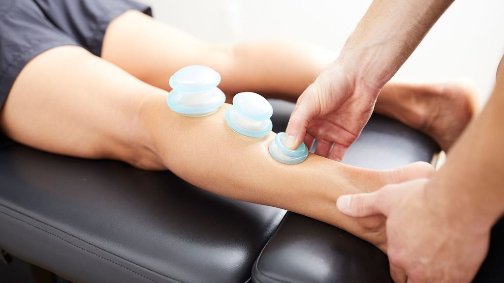 Injury Cupping