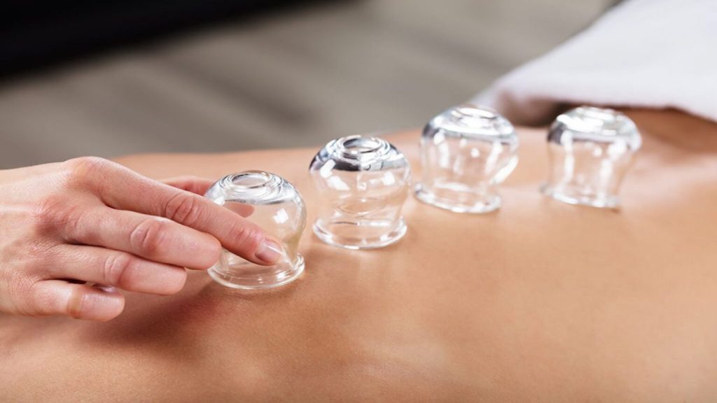 Full Body Cupping